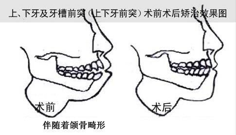 李春龙